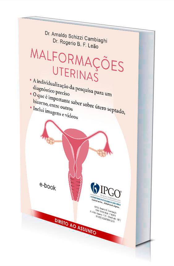 malformacao-uterinas-IPGO.jpg